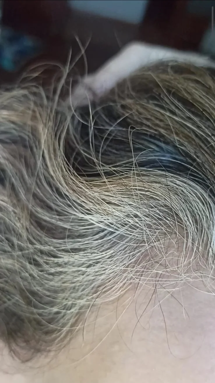 Qué hacer cuando las canas se vuelven amarillas